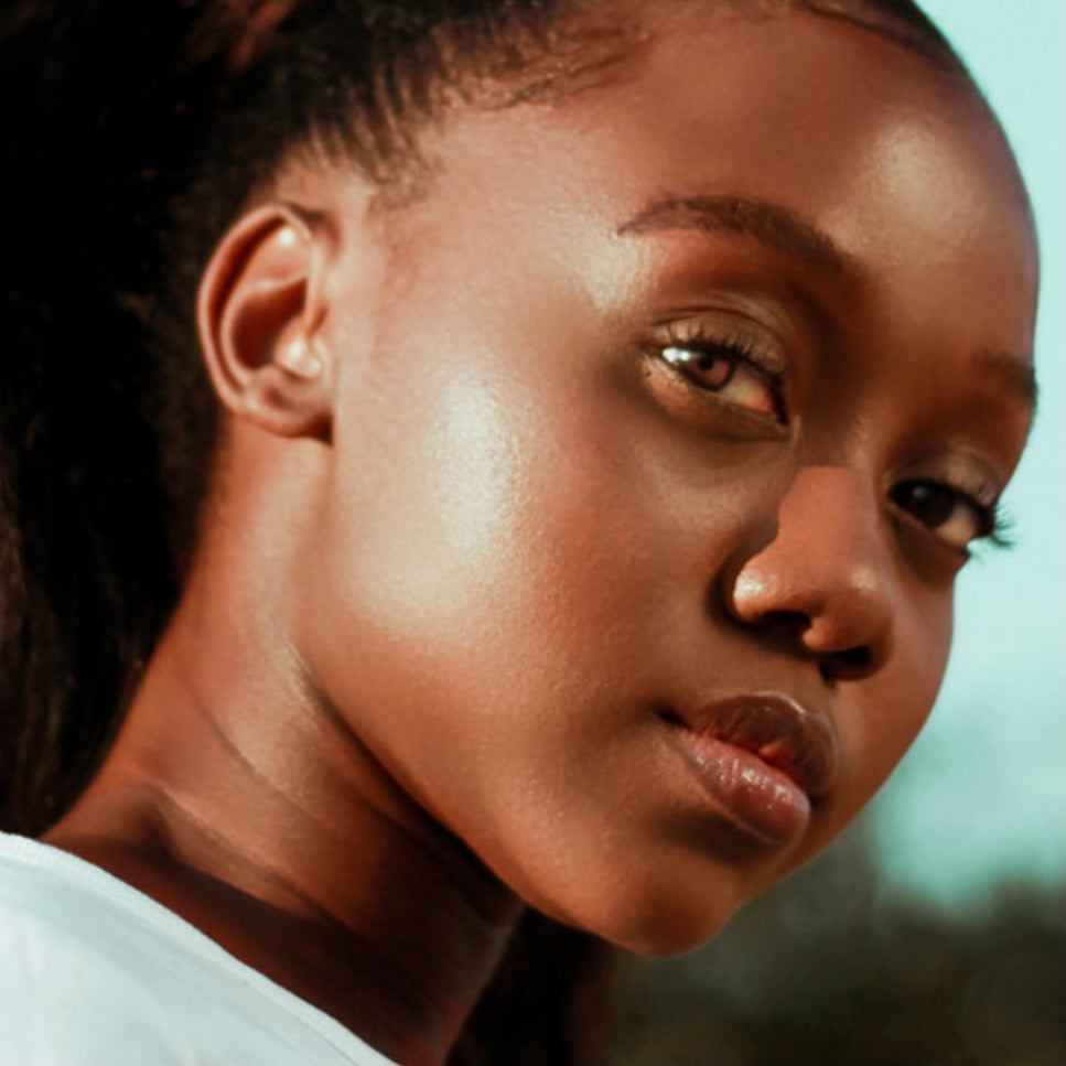 The 411 on Hyperpigmentation & Getting Rid of It