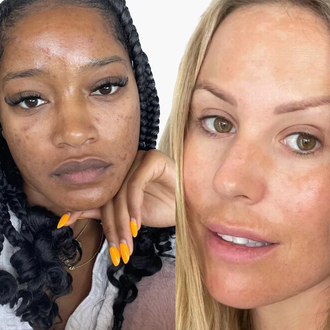 Keke Palmer & Kate Ferdinand with Acne